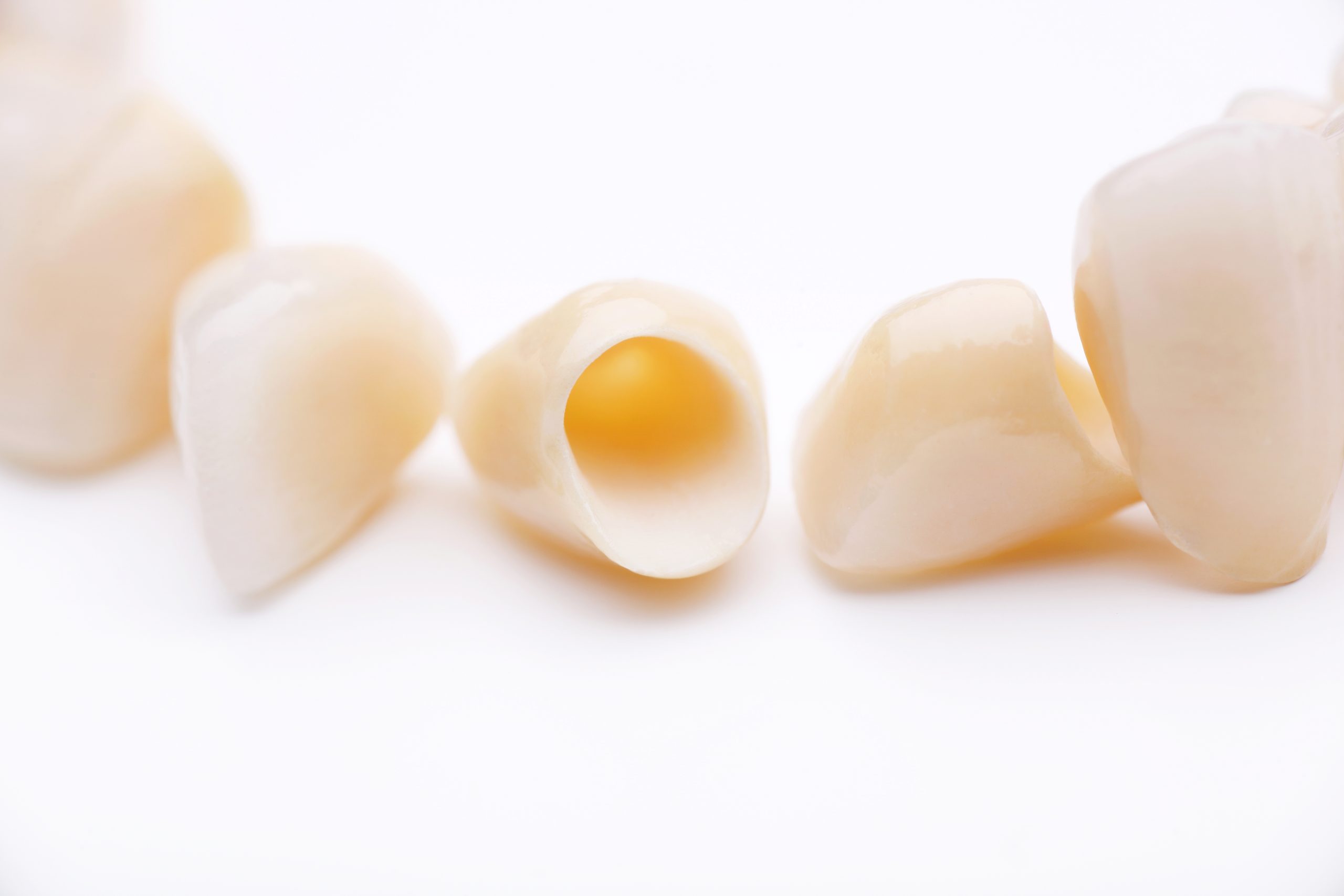 Dental crowns in a North York dentistry