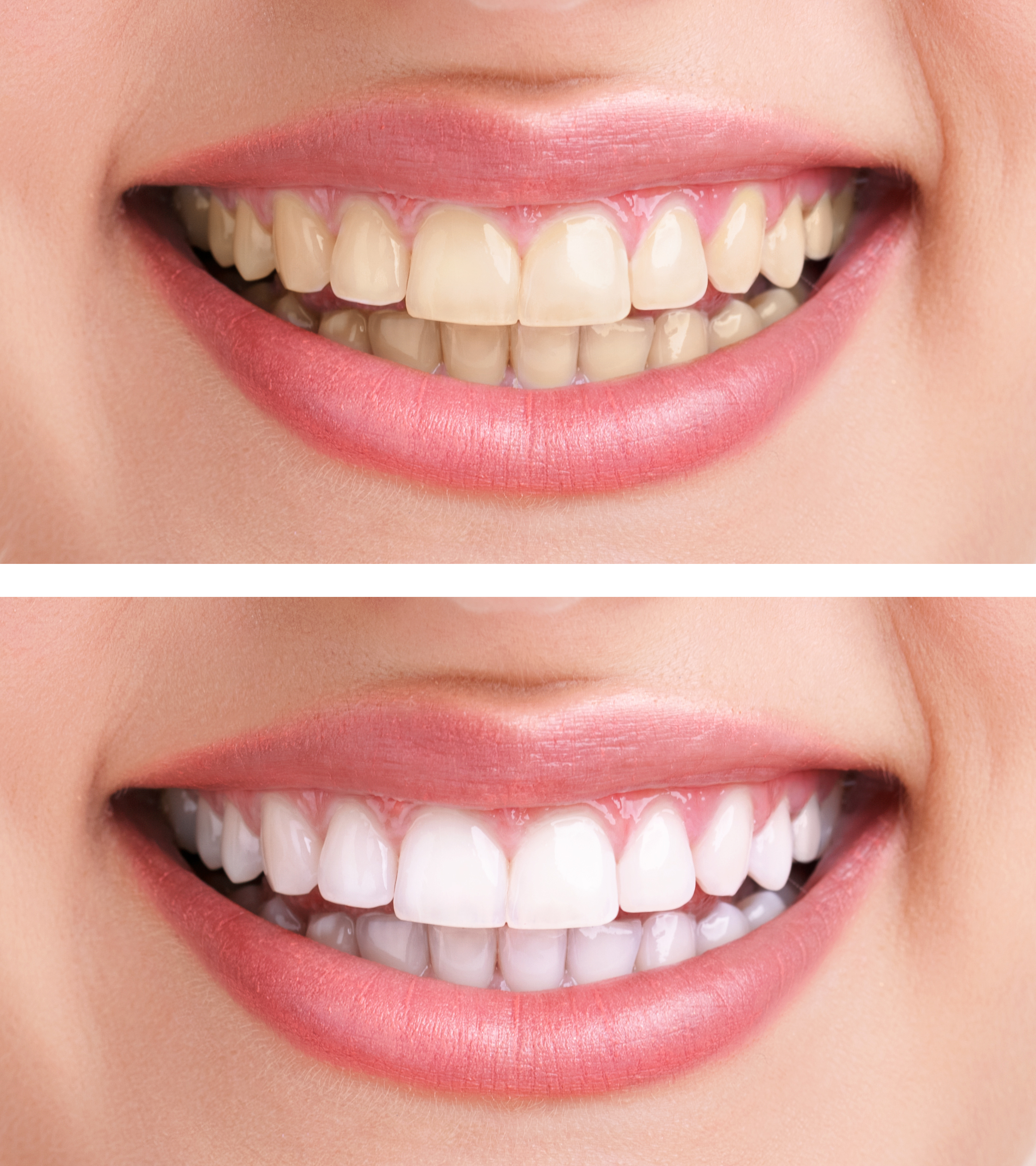 Tooth implant surgery in a North York dentistry